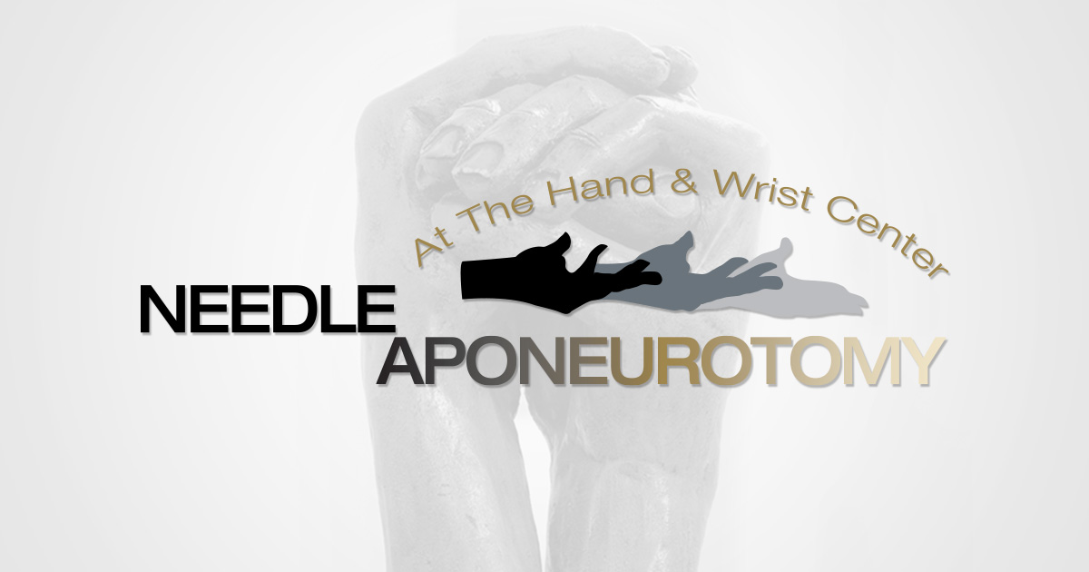 The Needle Aponeurotomy Procedure Needle Aponeurotomy Hand Surgery